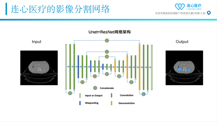 Live回顾 | 连心医疗朱森华博士：从AI切入，连心如何做好放疗智能靶区勾画？